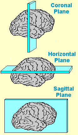 Die drei dimensionalen Ebenen des Gehirns