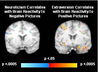Ansicht von vorn: Neurotische und extravertierte Gehirne